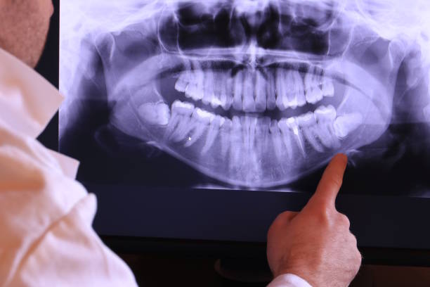 Best Emergency Dental Care for Abscessed Tooth in Roanoke Rapids, NC