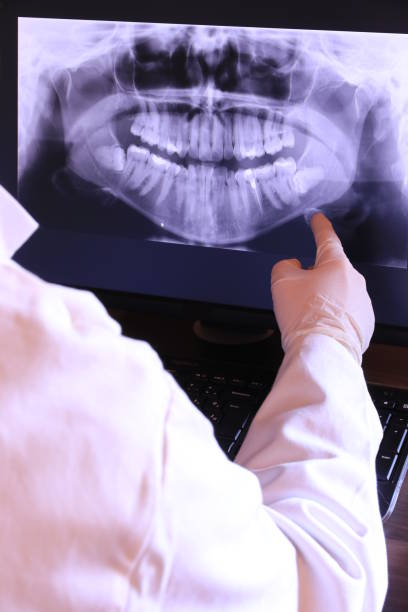 Best Emergency Dental Extractions in Roanoke Rapids, NC